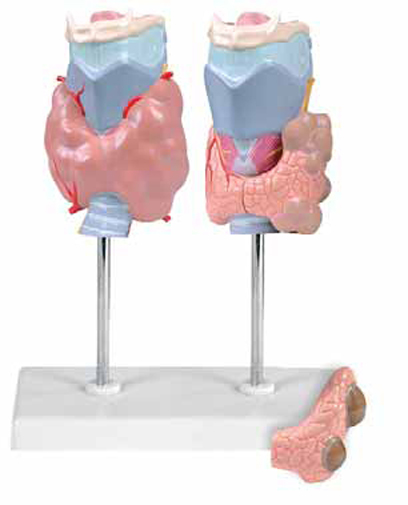 Thyroid Diseases, 4 Parts